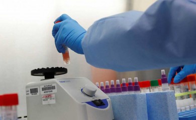 Retestiranja nakon izolacije za radnike većih kolektiva
