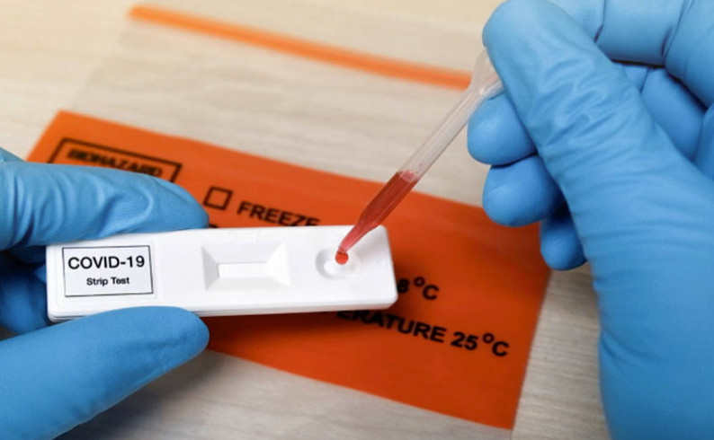 Neophodna veća kolektivna disciplina u sprečavanju širenja virusa korona