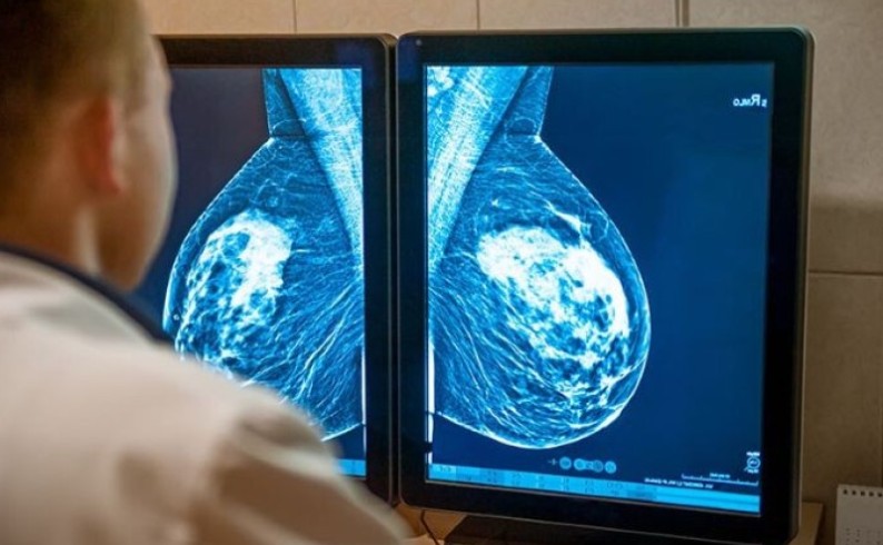 Svjetski dan borbe protiv karcinoma: Prevencija spasava živote